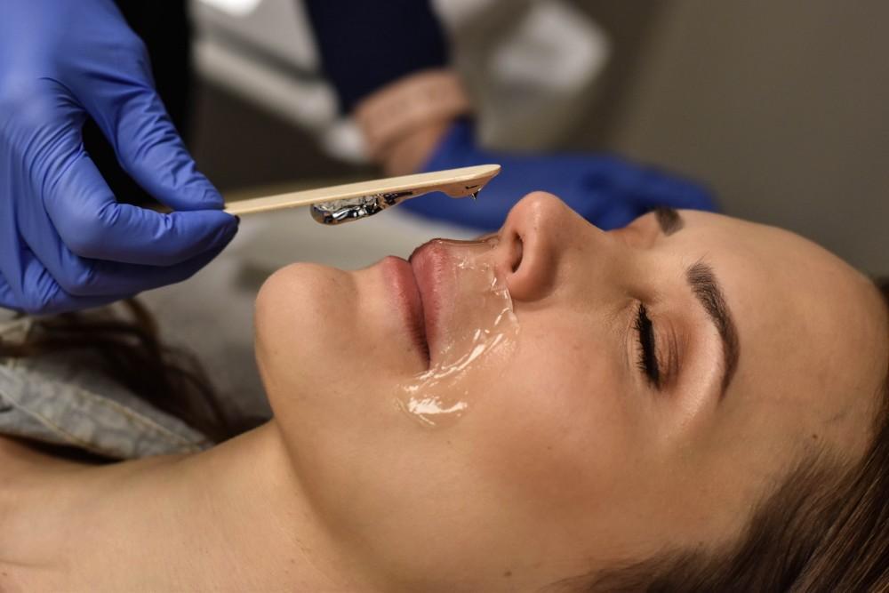 Permanent Hair Removal for Upper Lip Hair: What You Need to Know